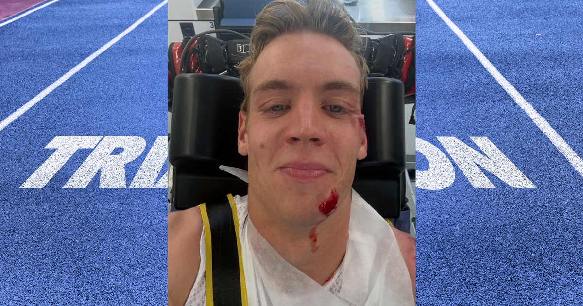 Accident slows down Bayreuth triathlete: Missed qualification for Hawaii